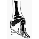 Näita Röntgenivõte kängitsetud naise jalg pilti