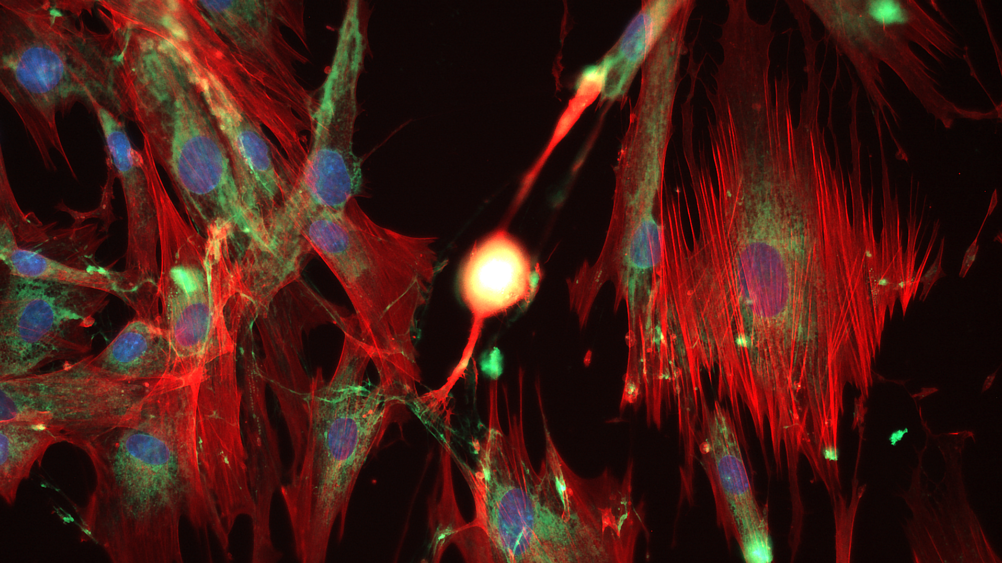Cell-Cell Communication in HDF Cultures