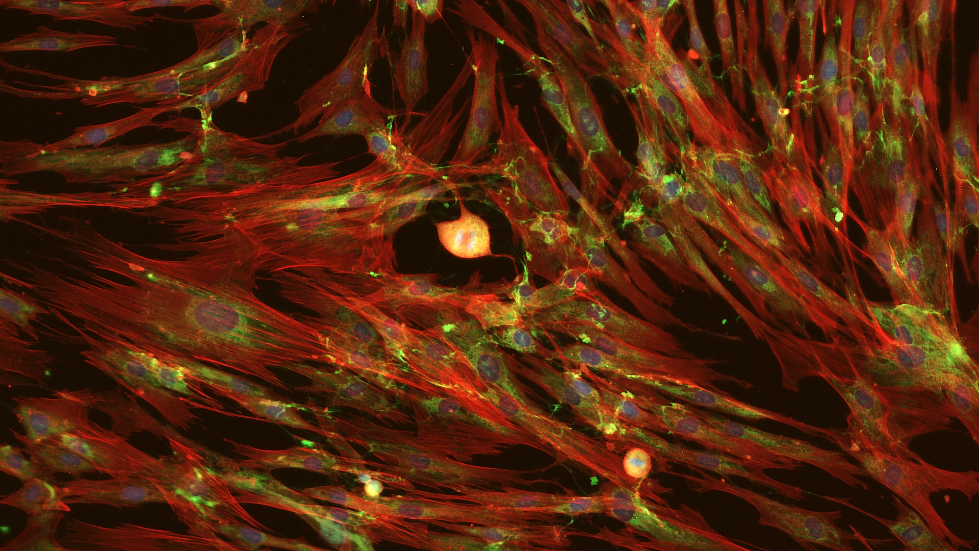 Cell-Cell Communication in HDF Cultures_2