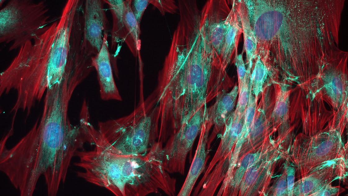  Amal D. Premarathna  Teos pealkirjaga "Cell-Cell Communication in HDF Cultures" 